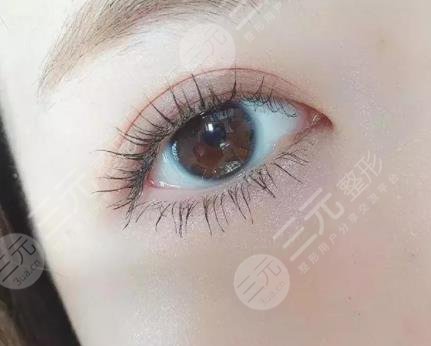 韓式or歐式雙眼皮合適更好，本文幫你分析到底適合什么風(fēng)格的~