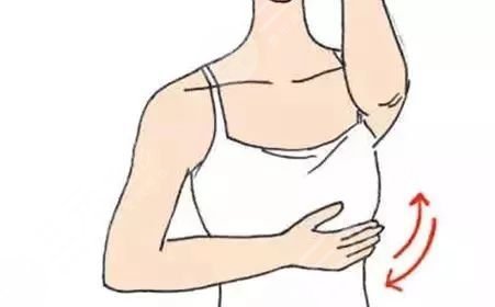 副乳切除手術(shù)幾天恢復(fù)