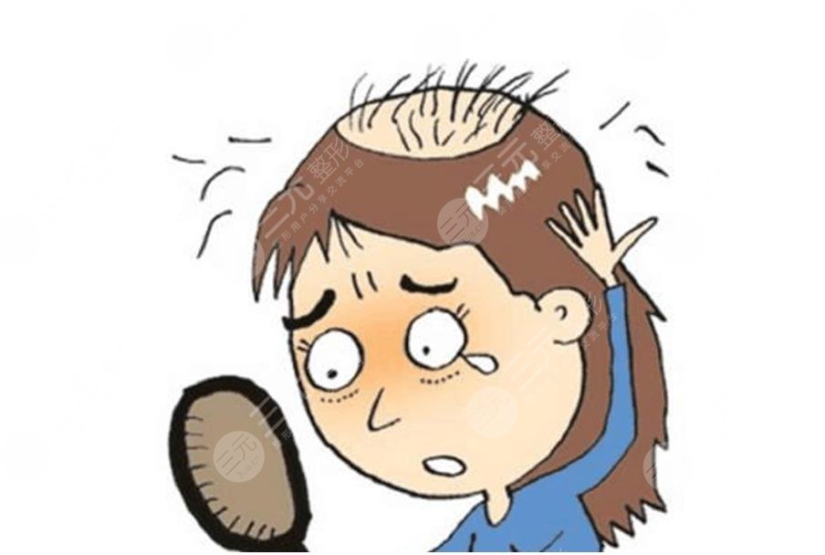 種植頭發(fā)后有飲食禁忌嗎