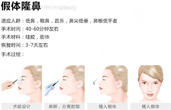 硅膠假體隆鼻