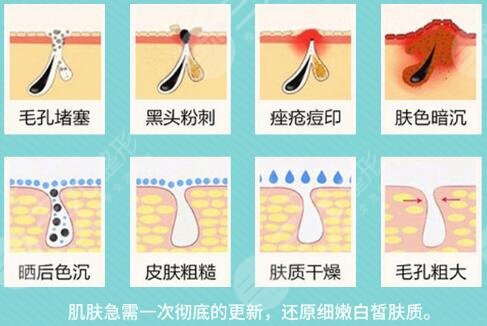 影響黑臉娃娃價格的因素
