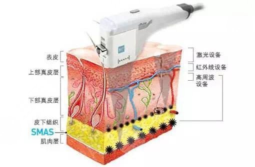 臉上紅血絲如何去除？怎么修復(fù)？