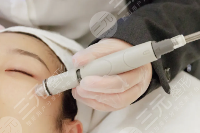 海菲秀多久做一次合適