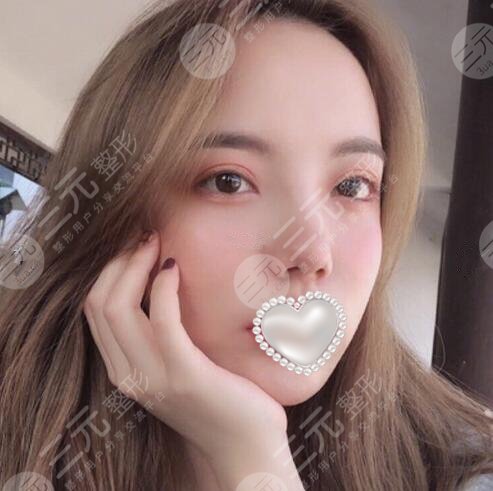 北京和顏美帕醫(yī)療美容激光祛痘案例