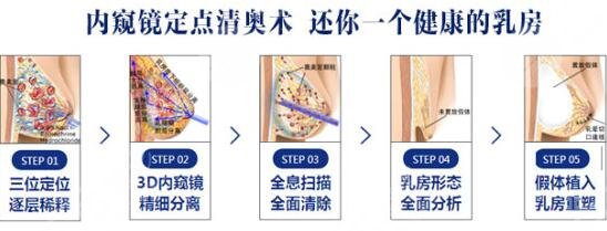 廣州荔灣區(qū)人民醫(yī)院奧美定取出
