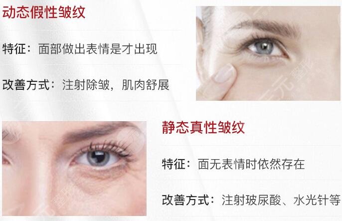 量子微雕美容會(huì)不會(huì)反彈