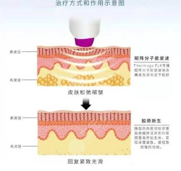做熱瑪吉的價(jià)格是多少