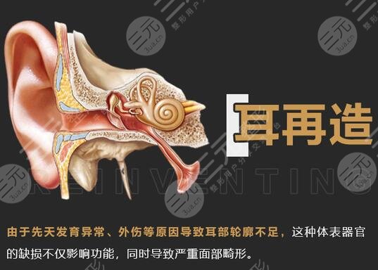 耳再造多少費(fèi)用？?jī)r(jià)格參考&手術(shù)科普，耳整形避雷指南！