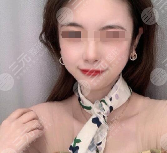注射后