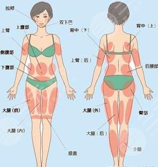 超脂塑溶脂適應(yīng)部位