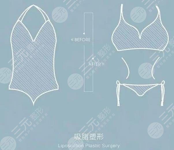 網(wǎng)絡(luò)瘋傳的超脂塑吸脂到底啥來頭