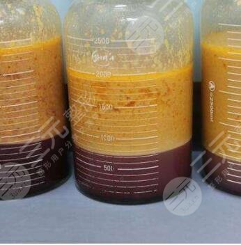 做超脂塑去哪個(gè)醫(yī)院可以呢