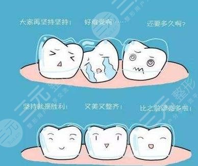 北京優(yōu)貝口腔醫(yī)院隱形矯正相關(guān)介紹