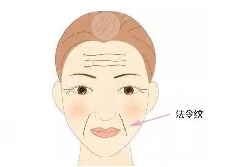 有法令紋怎么辦？去法令紋價格大概多少錢？附價格表