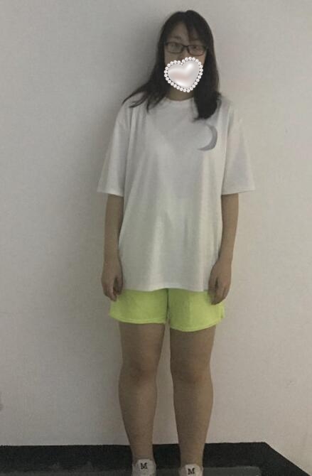 水動(dòng)力吸脂果圖