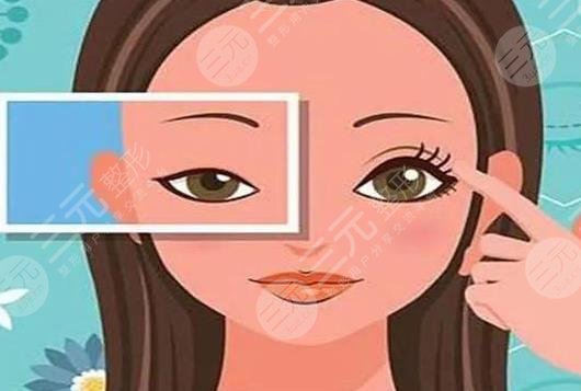 開眼角項目相關(guān)介紹