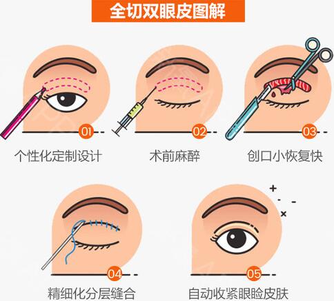 武漢蜜司整形醫(yī)院科普整形知識(shí)