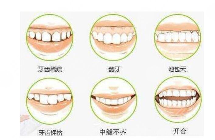牙科私人貴還是醫(yī)院貴