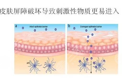 維納斯抗衰儀多少錢一次?原理_作用功_面部抗衰案例果圖來襲!