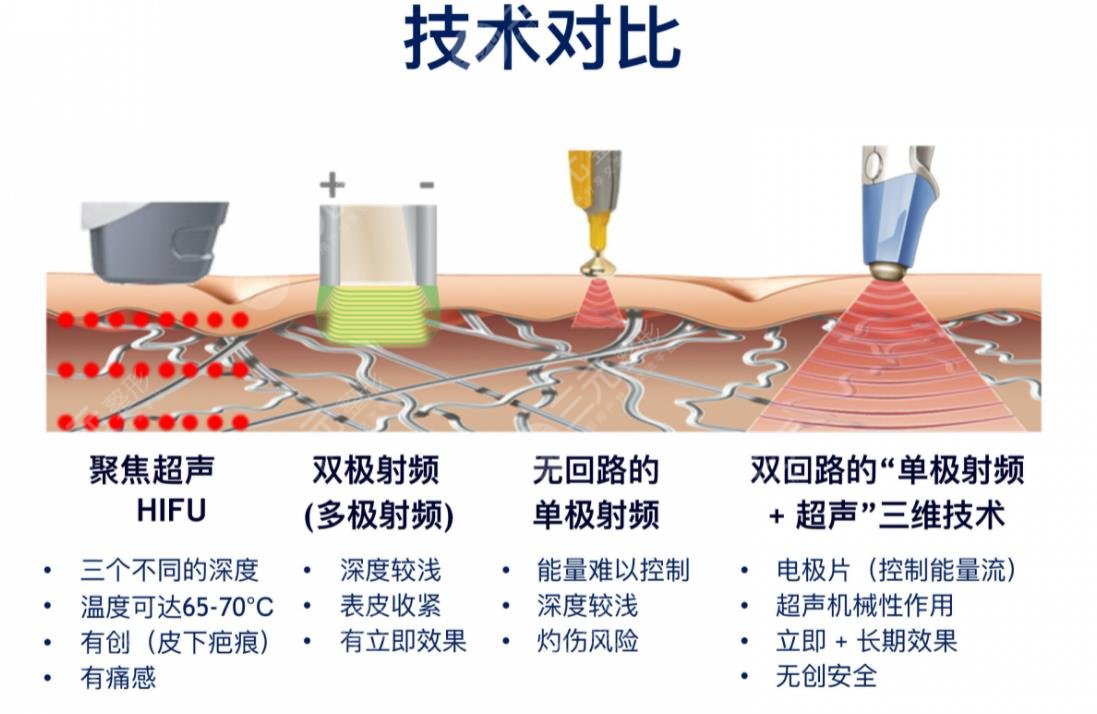 btl愛(ài)麗絲