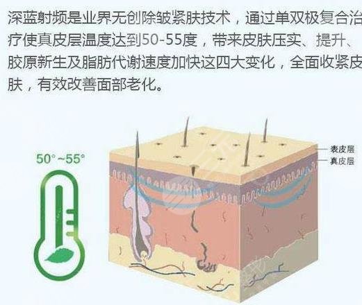 深藍(lán)射頻和熱拉提哪個(gè)好(區(qū)別)