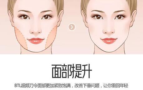 btl愛(ài)麗絲