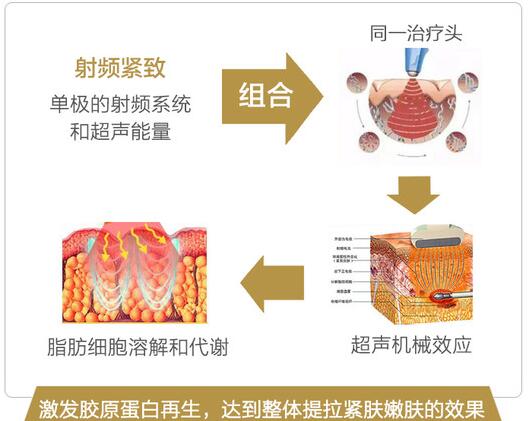 btl愛麗絲黑科技的原理