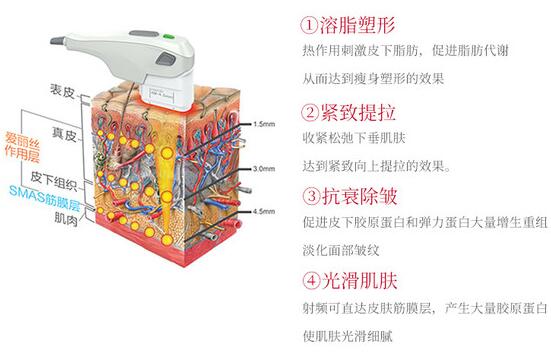 btl愛麗絲