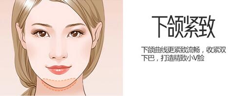 btl愛麗絲