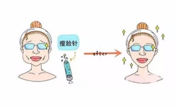 咬肌瘦臉
