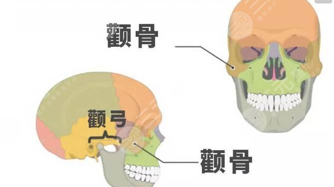 合肥藝星整形醫(yī)院科普磨骨手術(shù)知識