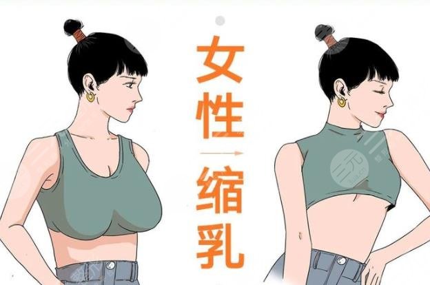 乳房縮小棒棒糖手術(shù)術(shù)前需要準(zhǔn)備哪些工作?