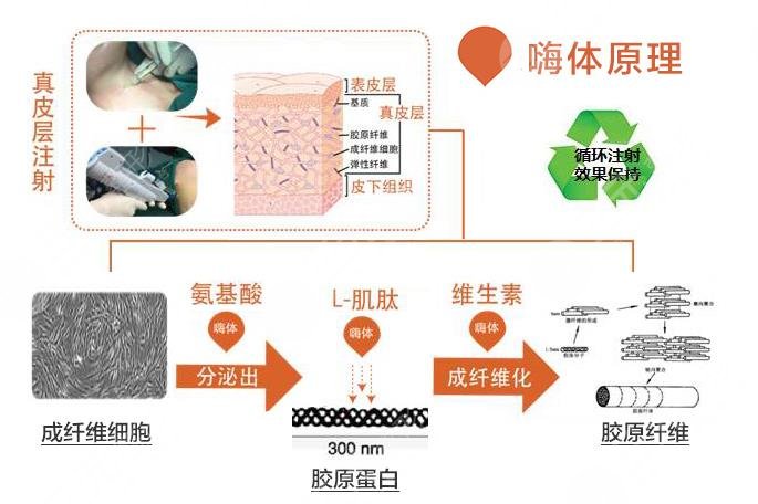 嗨體相關(guān)知識科普