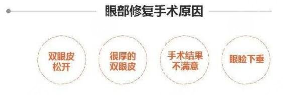 上海朱迪雙眼皮修復(fù)怎么樣