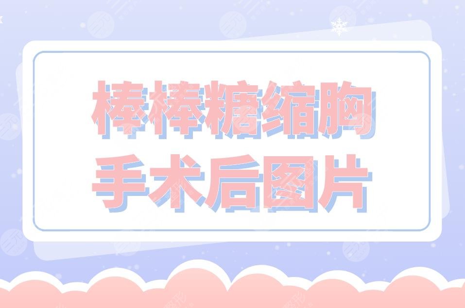棒棒糖縮胸手術(shù)后圖片分享！附手術(shù)原理介紹+手術(shù)注意事項(xiàng)