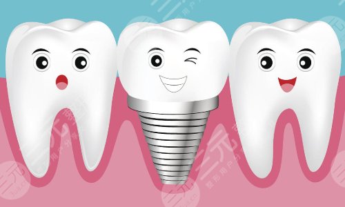 全口種植牙的利