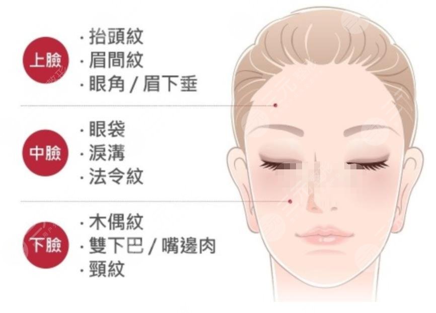 拉皮手術能夠維持幾年?