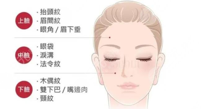 迷你小拉皮