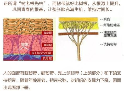 拉皮