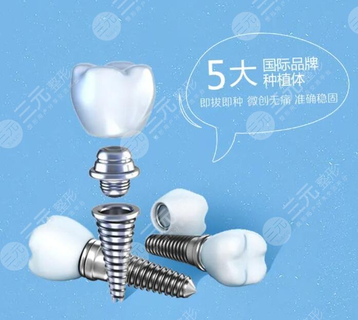 種植牙技術的價格