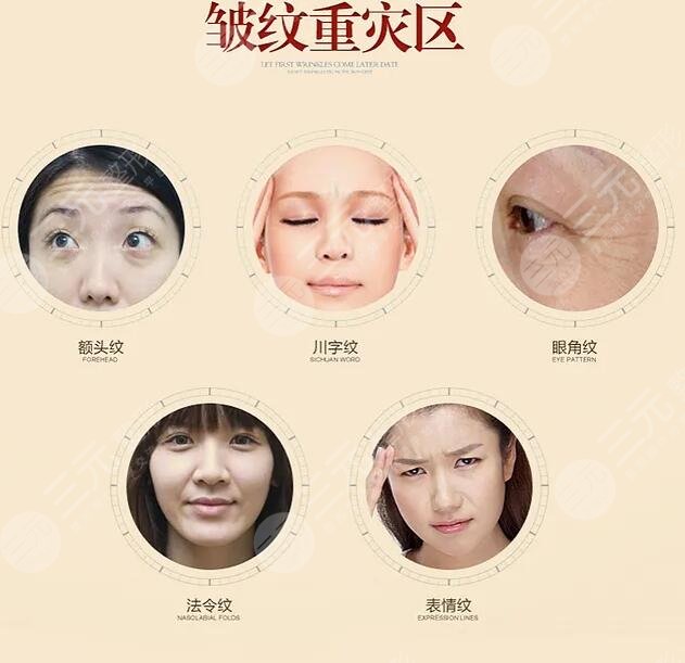 內(nèi)窺鏡拉皮手術(shù)降低風(fēng)險嗎