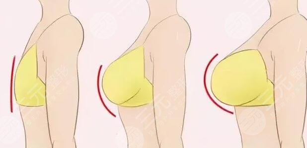 胸部大小