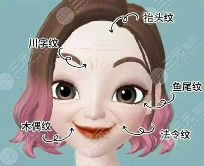皺紋產生