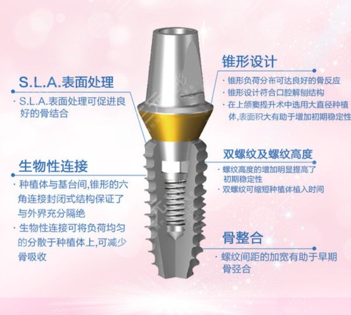 登騰種植牙后期穩(wěn)定性怎么樣