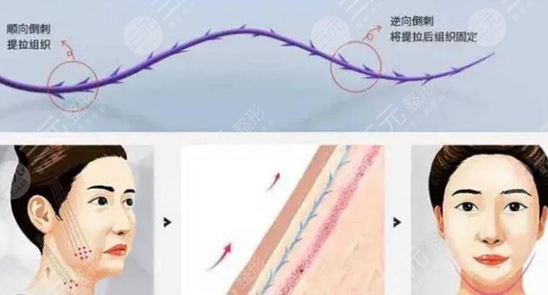提升抗皺
