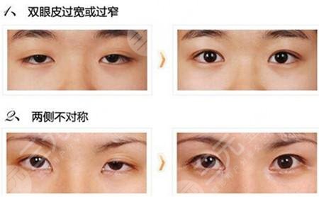眼部修復相關知識科普