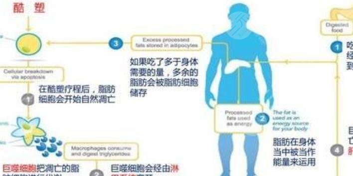 酷塑冷凍減