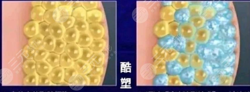 酷塑