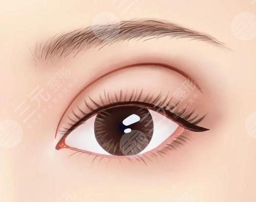 長春銘醫(yī)整形醫(yī)院熱門項(xiàng)目科普介紹(雙眼皮