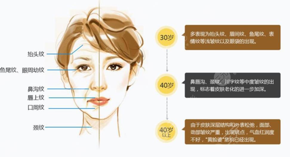 激光除皺